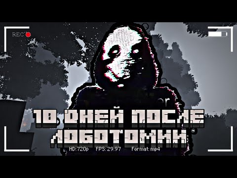 Видео: МНЕ СДЕЛАЛИ ЛОБОТОМИЮ В МАЙНКРАФТЕ | Salvation Archives: Lobotomy