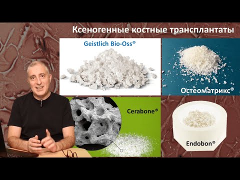 Видео: Направленная Костная Регенерация (НКР) 3. Алло- и Ксеногенные (Аллопластические)  трансплантаты.