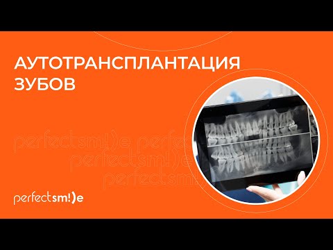 Видео: 👉 Аутотрансплантация зубов: что это и для чего проводят?
