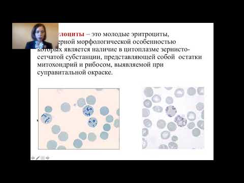 Видео: Лабораторная диагностика анемий   часть 1