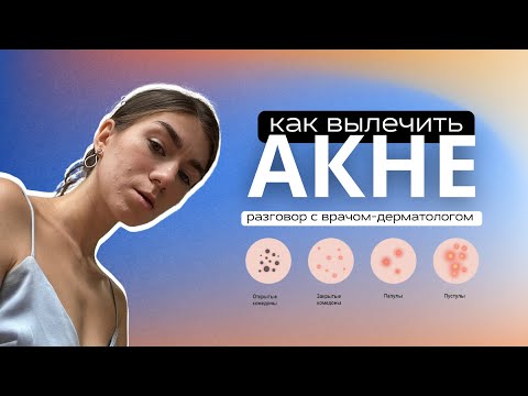 Видео: акне | как я избавилась от прыщей