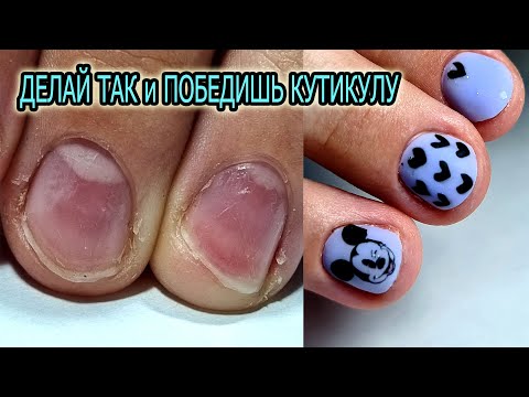 Видео: ЕСЛИ ТАК ДЕЛАТЬ то СПРАВИТЕСЬ с ВЛАЖНОЙ ЭЛАСТИЧНОЙ кутикулой КАЖДЫЙ