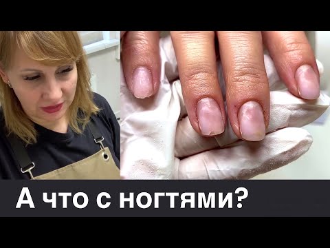 Видео: Сама сняла ногти 😨 Ругаюсь с ботом. Мы на Ты не переходили))