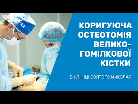 Видео: Остеотомія колінного суглоба / Остеотомия коленного сустава