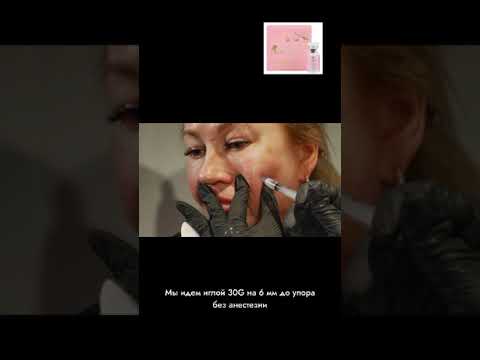 Видео: Стройность.Липолитик.