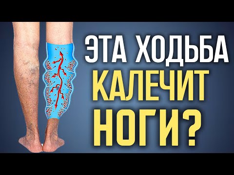 Видео: После 60 НЕЛЬЗЯ так ходить! Это разрушает здоровье и суставы!