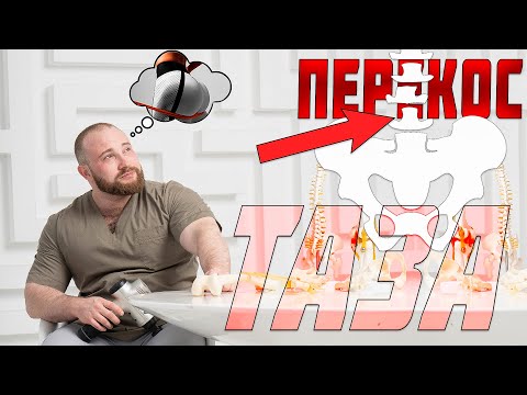 Видео: Перекос таза: проблемы и решения | Доктор Королёв