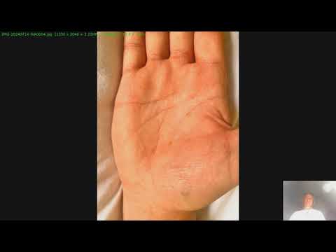 Видео: Разбор примера переезда по руке. И джйотиш.