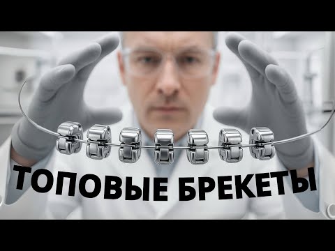 Видео: Лучшие брекеты в 2025 году. Рекомендации ортодонта без маркетинга