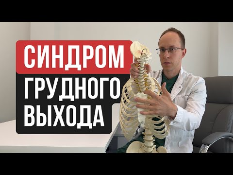 Видео: Синдром верхней апертуры - частая причина онемения и боли в руке