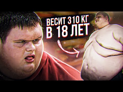 Видео: САМЫЙ ТОЛСТЫЙ ПОДРОСТОК в Америке. 310 КГ в 18 ЛЕТ!