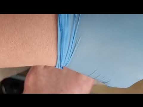 Видео: Побег от кошмара: История одного вросшего ногтя.