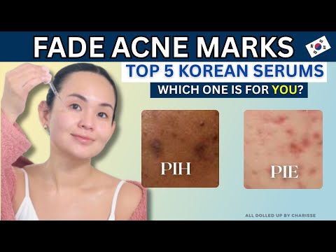 Видео: Устраняем следы от прыщей🚨Корейский уход за кожей, который работает!