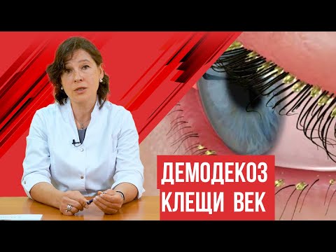 Видео: Демодекоз век, когда нужно лечение и каким оно должно быть?