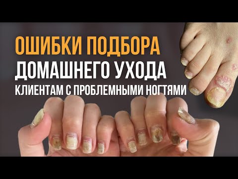 Видео: Уход за проблемными ногтями #ногти #подолог #подология #грибок #онихолизис