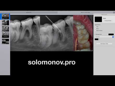 Видео: Разбор клинического случая - от диагностики к лечению и наблюдению