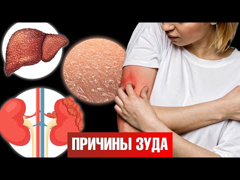 Видео: Чешется кожа? 15 причин зуда, о которых вы точно не знали 🧐