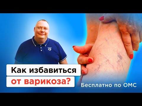 Видео: Это поможет вам избавиться от варикоза! Причины и бесплатное лечение по ОМС