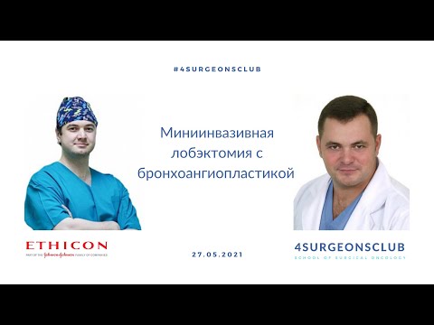 Видео: Миниинвазивная лобэктомия с бронхоангиопластикой