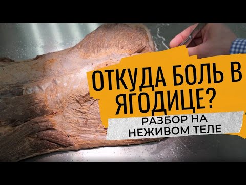 Видео: Седалищный нерв | Глубокая БОЛЬ в ягодице | разбор: НЕЖИВОЕ тело