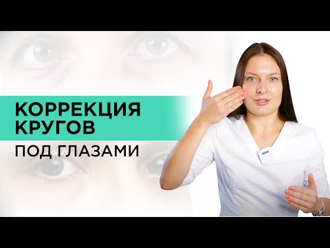 Видео: Как ИЗБАВИТЬСЯ от кругов под глазами? Методы устранения