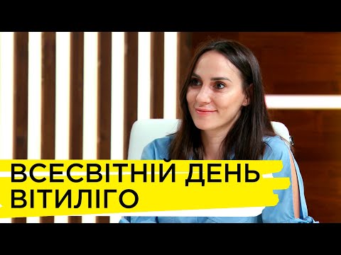 Видео: Вітиліго – що це за захворювання і як його визначити? – Тетяна Бойчук