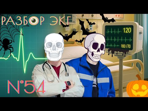 Видео: Разбор ЭКГ № 54