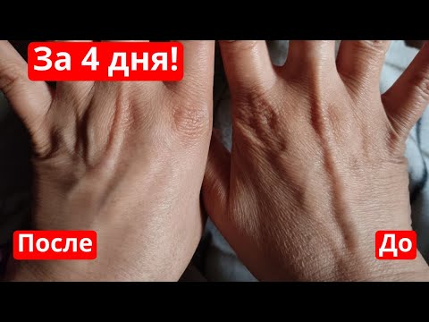 Видео: Омолодить и подтянуть кожу за 4 дня! И помолодеть на 10 лет! Недорогие аптечные средства для кожи.