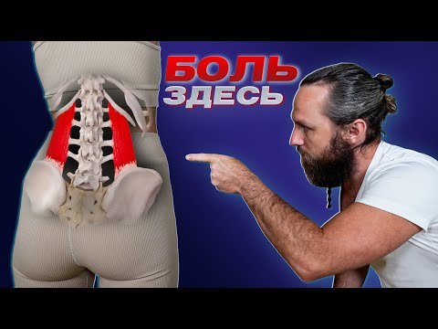 Видео: ТОП-1 Причина боли в спине, которую игнорируют врачи!