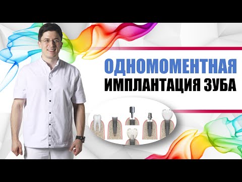 Видео: Одномоментная имплантация зуба [ немедленная имплантация в день удаления зуба ] сразу.