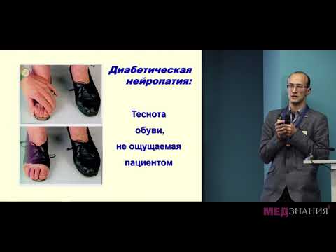 Видео: Синдром диабетической стопы в практике эндокринолога и терапевта