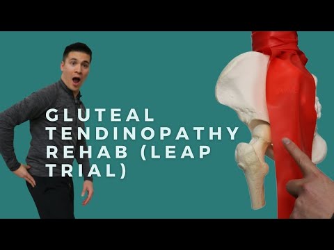 Видео: Реабилитационные упражнения при тендинопатии ягодичных мышц (вертельном бурсите/боли в боковой ча...