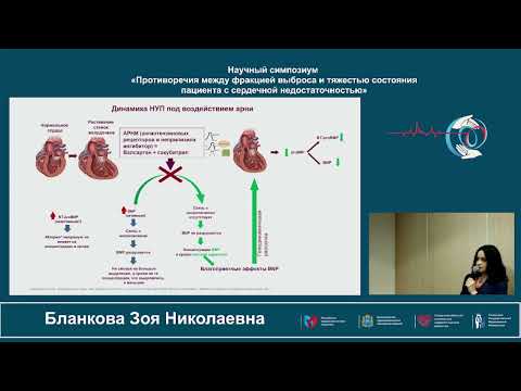 Видео: 20.10 Противоречия между фракцией выброса и тд