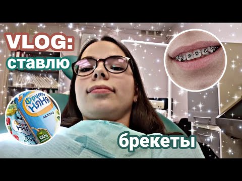 Видео: VLOG:СТАВЛЮ БРЕКЕТЫ//Мои ощущения  #брекеты #мнепоставилибрекеты #braces