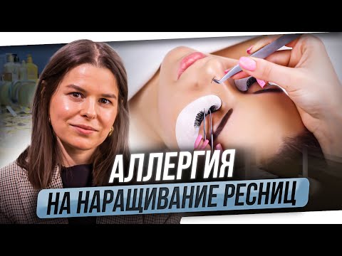 Видео: Аллергия на наращивание ресниц. На какие материалы может быть аллергическая реакция.