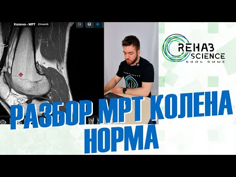 Видео: МРТ коленного сустава. НОРМА