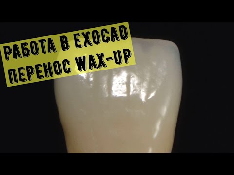 Видео: Работа в exocad, перенос ваксапа на препарированные зубы.