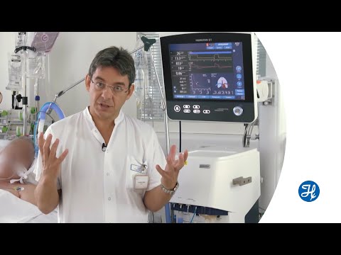 Видео: Adaptive Support Ventilation (ASV) - Как она работает?