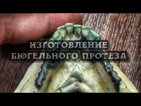 Видео: Изготовление Бюгельного протеза /Этапы производства /Обработка и полировка бюгеля