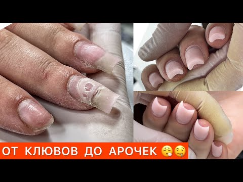 Видео: СТАЛЕКС ПИЛОЧКИ💥ОТСЛОЙКИ ПО БОКАМ И ОТ КУТИКУЛЫ С ГЕЛЕМ🧐