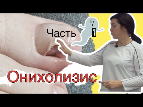 Видео: Онихолизис - механические повреждения (самая крутая лекция в рамках ютуба) #podolog#goloh#онихолизис