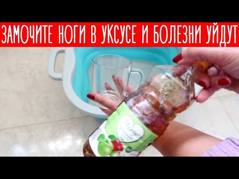 Видео: ЗАМОЧИТЕ ноги в УКСУСЕ и все БОЛЕЗНИ уйдут