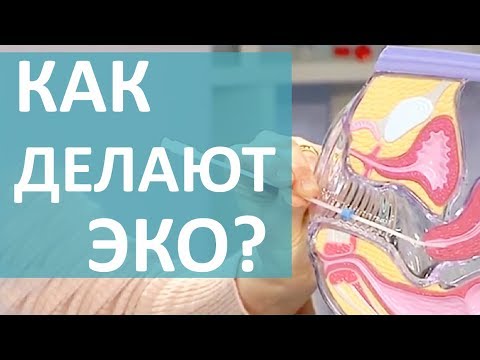 Видео: ЧТО ТАКОЕ ЭКО? ЭКО: ШАНС БЫТЬ МАМОЙ!