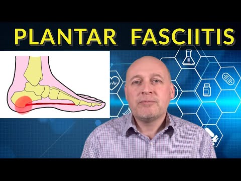 Видео: Подошвенный фасциит: ПРАВДА. Никаких глупых заявлений о мгновенном решении!