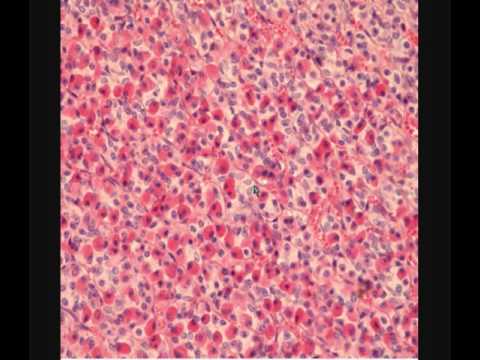 Видео: ГИПОФИЗ.  PITUITARY GLAND. В световой микроскоп.