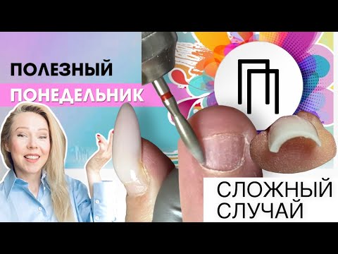 Видео: Сложные случаи😕 варианты решения