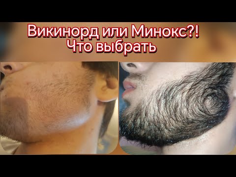 Видео: Викинорд или лосьон от Андрея бороды? Что лучше для роста бороды. Выпуск 85