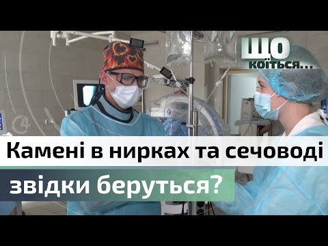 Видео: Як з’являються камені в нирках і чому пацієнтів більшає | процес видалення | Чернівецька ОКЛ | С4