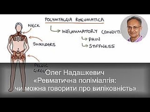 Видео: Олег Надашкевич 6 вересня 2025