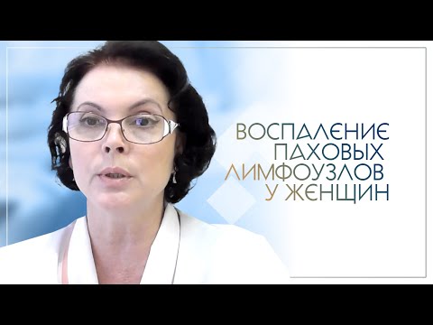 Видео: Воспаление паховых лимфоузлов у женщин
